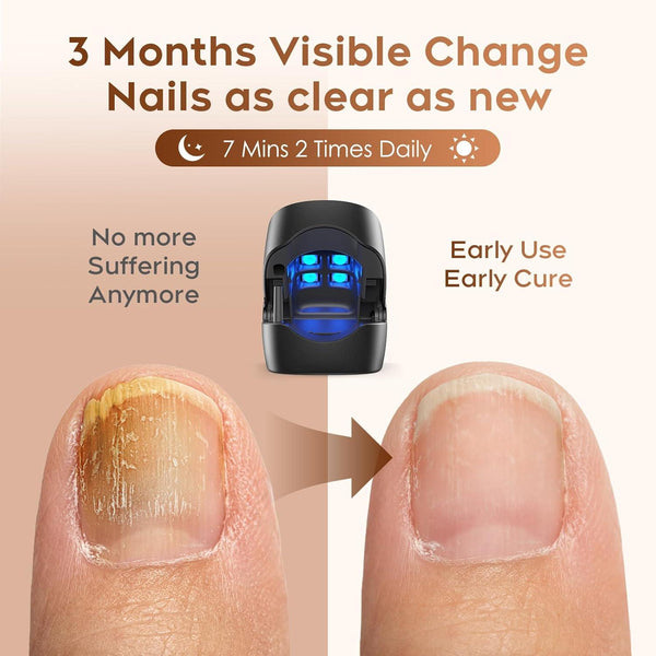 NailRestore™