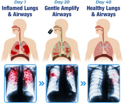 🛡️ LungRaksha™ – Breathe Easy, Feel Good