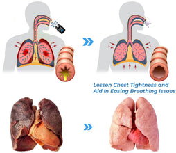 🛡️ LungRaksha™ – Breathe Easy, Feel Good